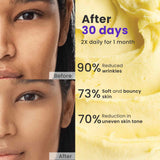Anti Ageing Cream