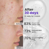 Face Spot Corrector