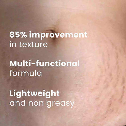 Anti Stretch Marks Oil