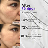 Anti Ageing Serum