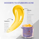 Acne Defense Pack: Acne Erase Cream+ Acne Shield Moisturizer